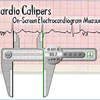 Cardio Calipers