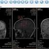 XRayline Workstation